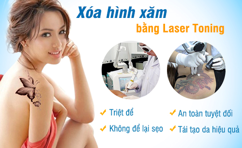 xoa-xam-bang-laser