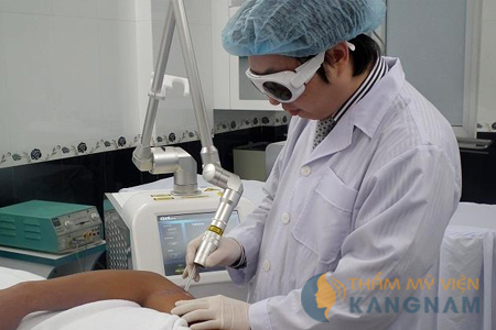 Xóa xăm bằng Laser Toning có mất nhiều thời gian không?