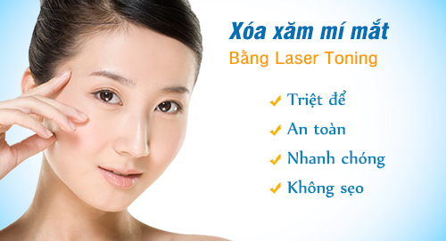 Xóa xăm mí mắt an toàn bằng công nghệ Laser Toning
